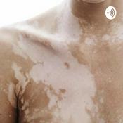 Podcast Let’s talk Vitiligo