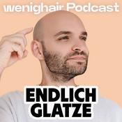 Podcast wenighair Podcast – Haarausfall? Endlich Glatze!
